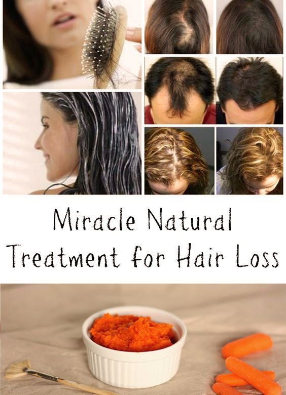 Miracle Natural Treatment for Hair Loss