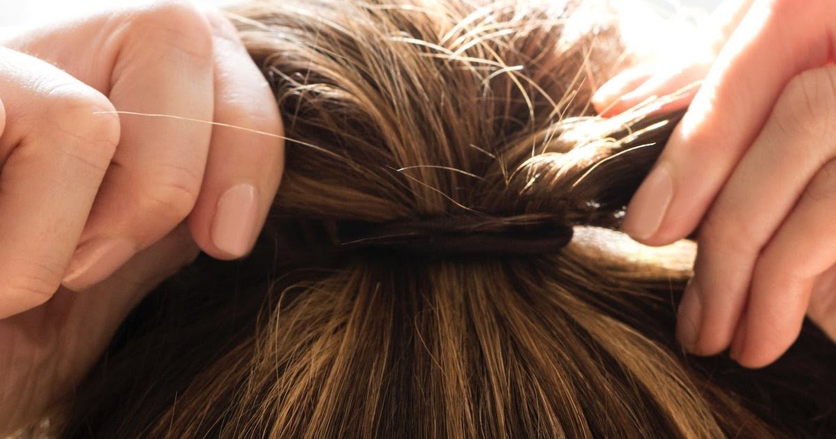 Molly Chirnside: Do you know what causes thinning hair ...