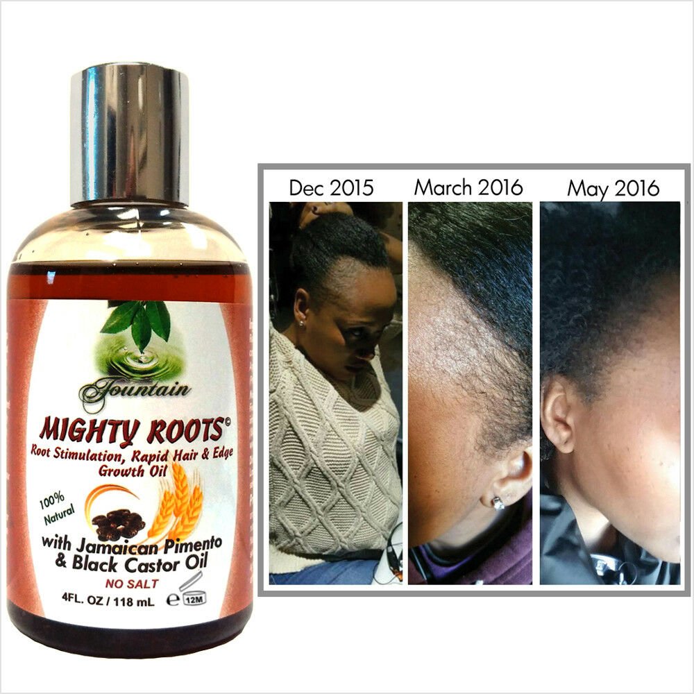 Natural Hairline Edge &  Hair Growth Oil/Jamaican Pimento and Black ...