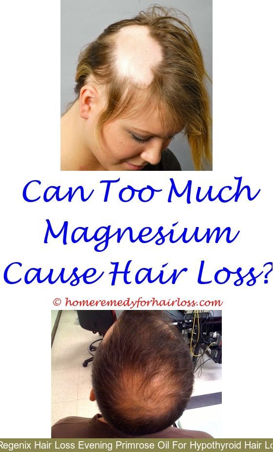 Natural Treatment For Hair Loss Due To Menopause