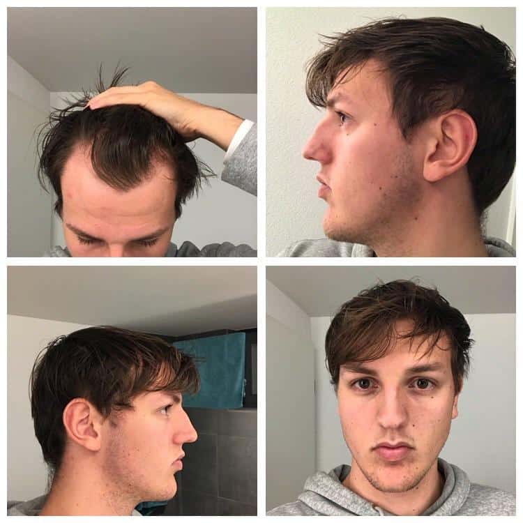 Need help / advice badly. I have extremely flat / thin hair and have ...