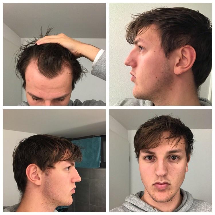 Need help / advice badly. I have extremely flat / thin ...