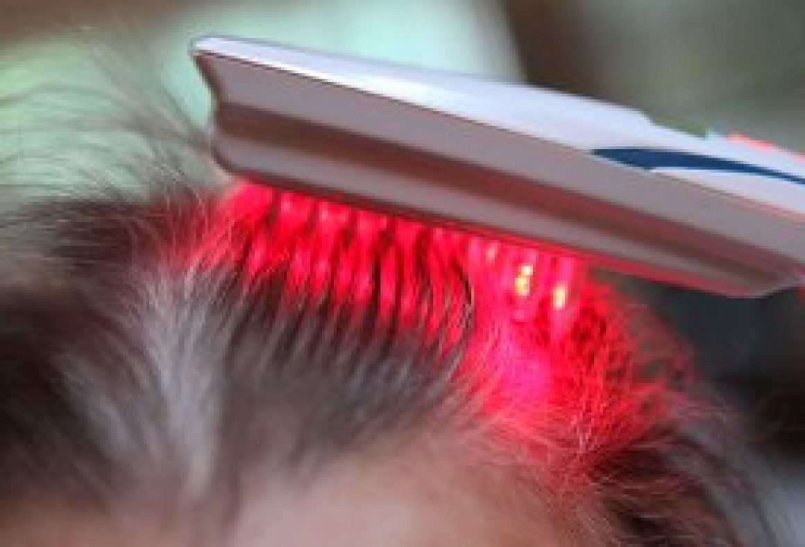 New Study Shows Low Level Laser Therapy (LLLT) May be an Effective Hair ...