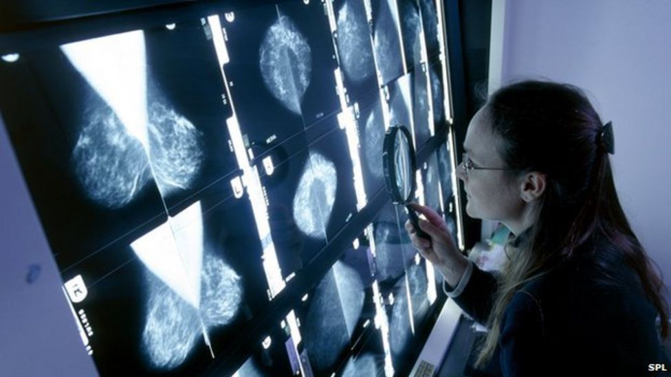 NHS says no to new breast cancer drug Kadcyla
