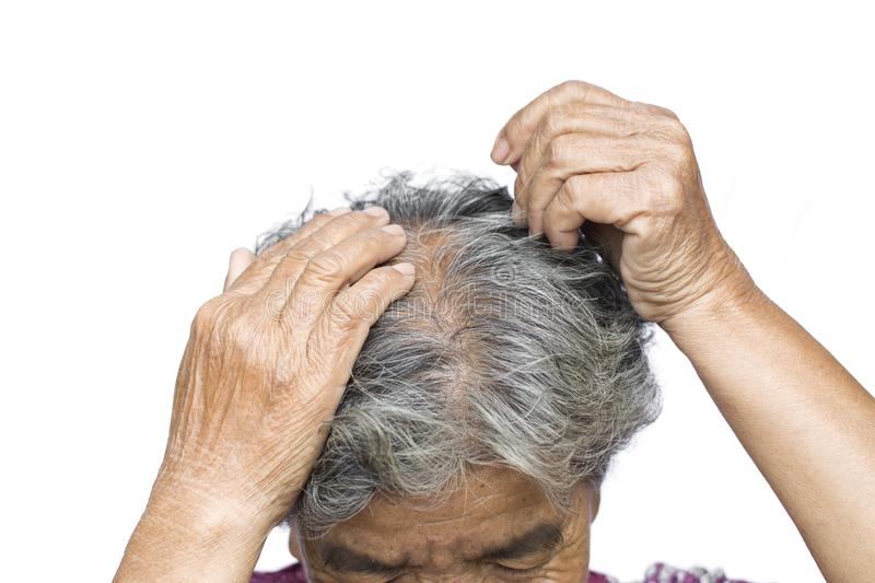 Old Woman Felt A Lot Of Anxiety About Hair Loss Issue ...