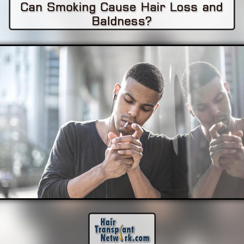 Pin on Hair loss for men