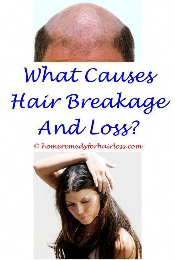 Pin on Hair Loss Remedies And Help