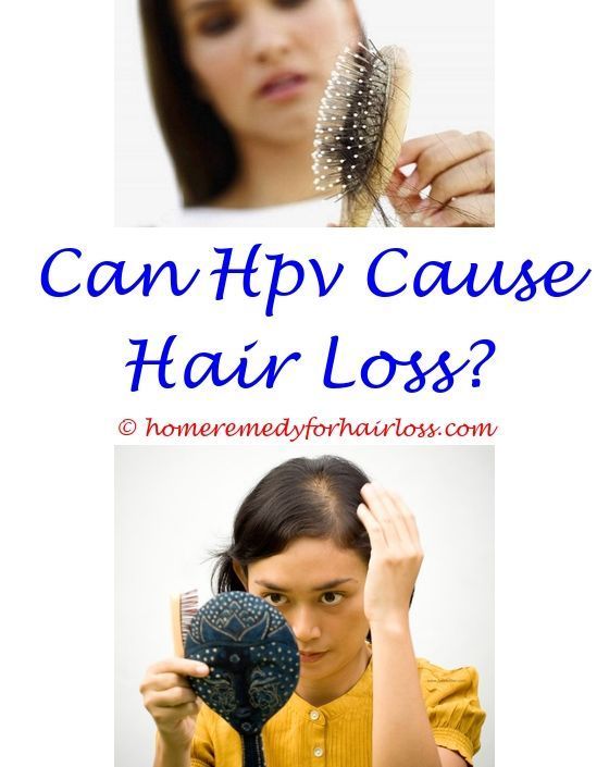 Pin on Women And Hair Loss Treatments