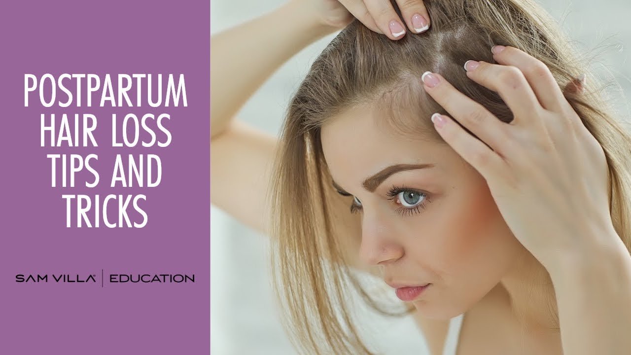 Postpartum Hair Loss Tips and Tricks