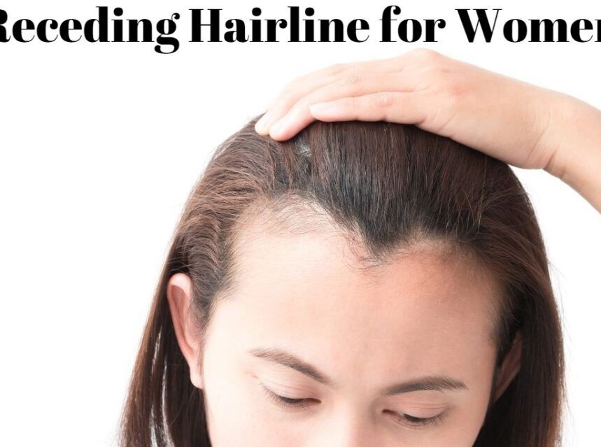 Receding Hairline for Women