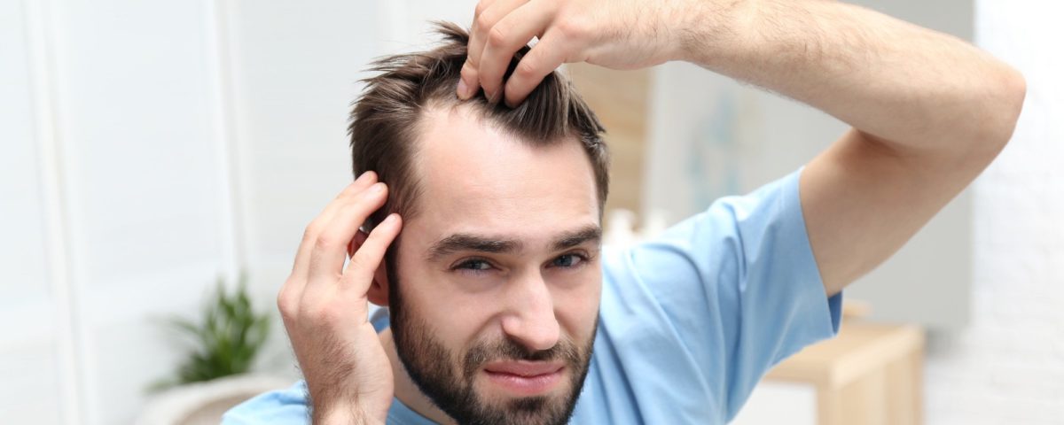 Receding Hairline: What To Do When You Are Losing Hair