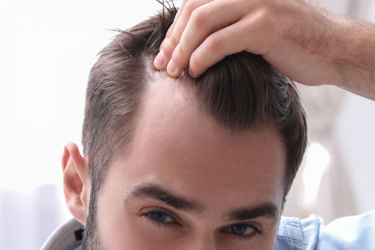 Receding hairline: why it happens and how to fix it