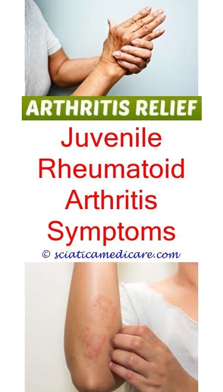 rheumatoid arthritis pictures daily express arthritis new ...