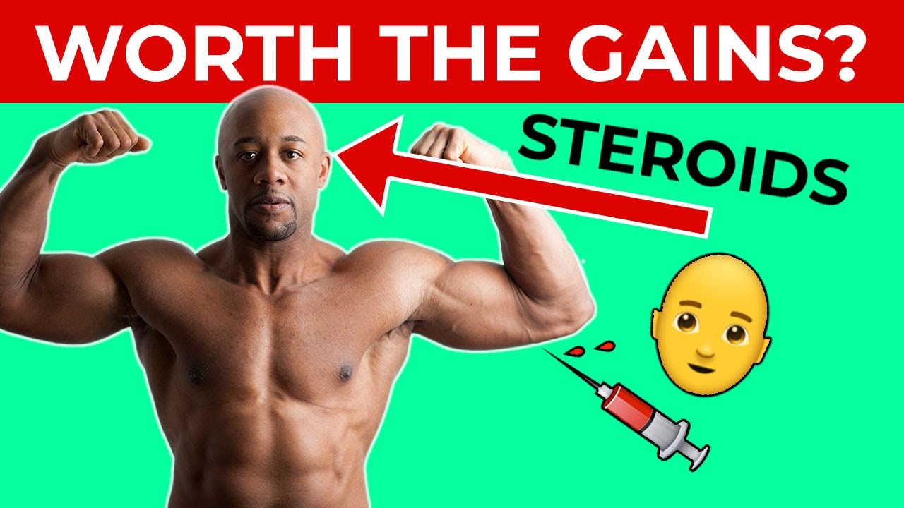 *SAD TRUTH* Can Steroids Cause Hair Loss? Is it Reversible ...
