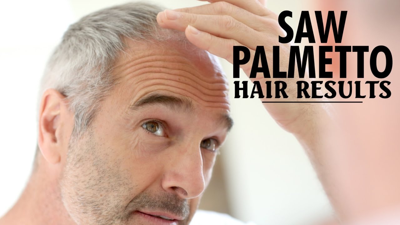 Saw Palmetto Hair Loss Results