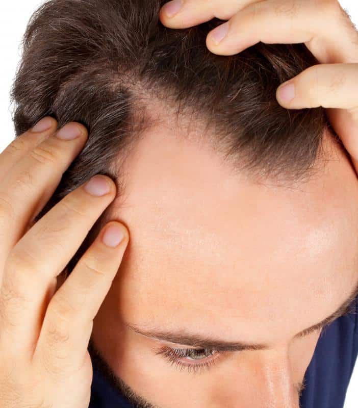 Scalp Tingling Hair Loss / Numbness In Head Why Does It Happen ...