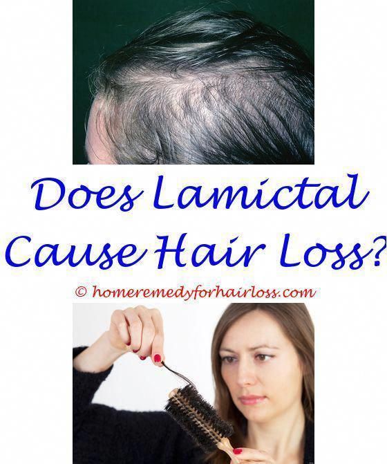 sensitive scalp hair loss