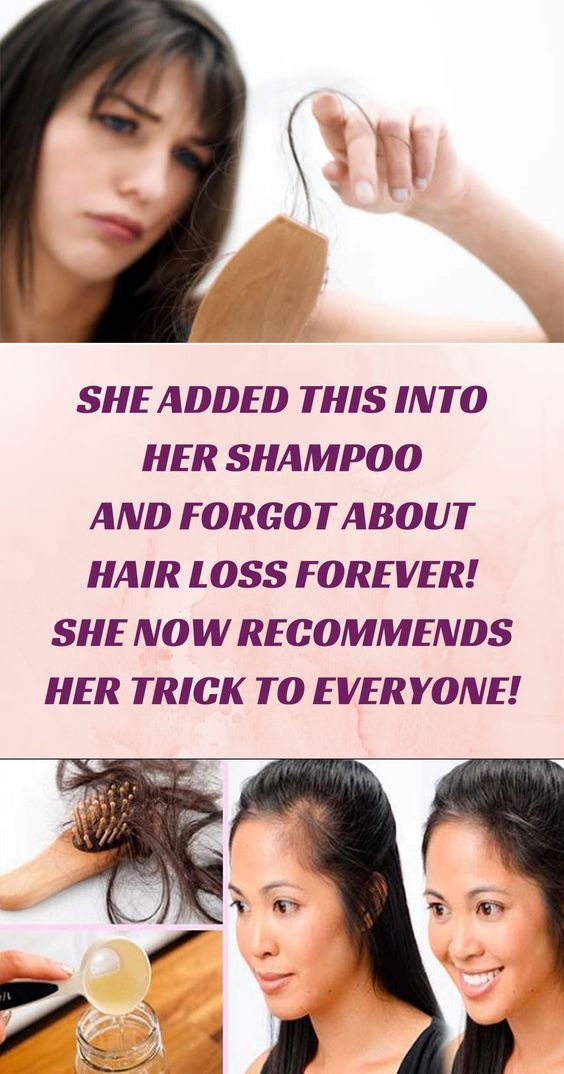 She Added This Into Her SHAMPOO And Forgot About HAIR LOSS ...