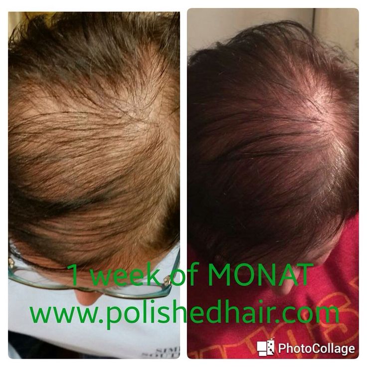 She used the Monat intensive repair spray and the Monat volume line ...