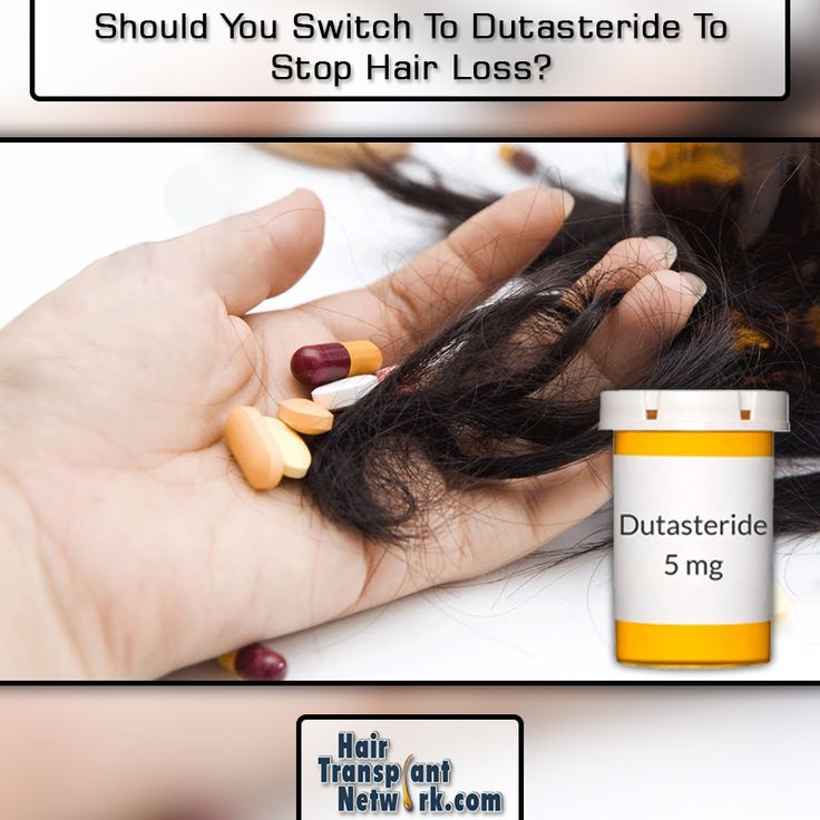 Should You Switch To Dutasteride To Stop Hair Loss?
