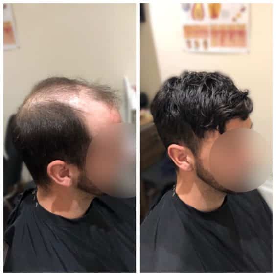 SPONSORED: Kirriemuir salon offers unique hair loss service