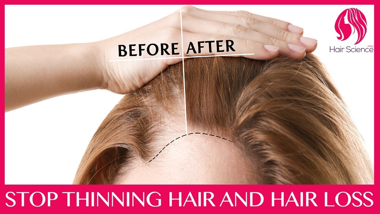 Stop hair falling out in clumps and thinning
