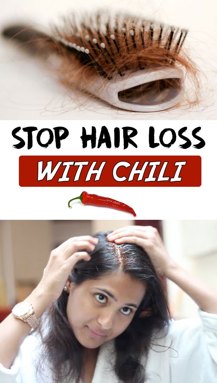 Stop hair loss with chili