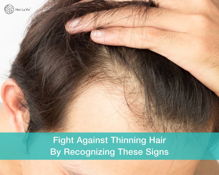 Stopping It Before It Starts: 5 Signs Of Thinning And Hair ...