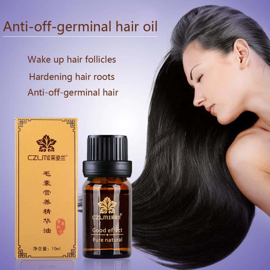 Strong Anti off Germinal Hair Oil 10ML Fast Hair Growth Dense Regrowth ...