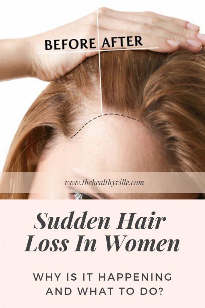 Sudden hair loss in women can happen from various reasons ...