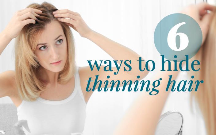 Suffering with thinning hair can be disappointing and nerve