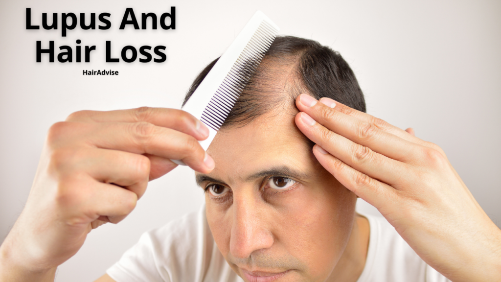 Symptoms of Lupus and Cause Hair Loss