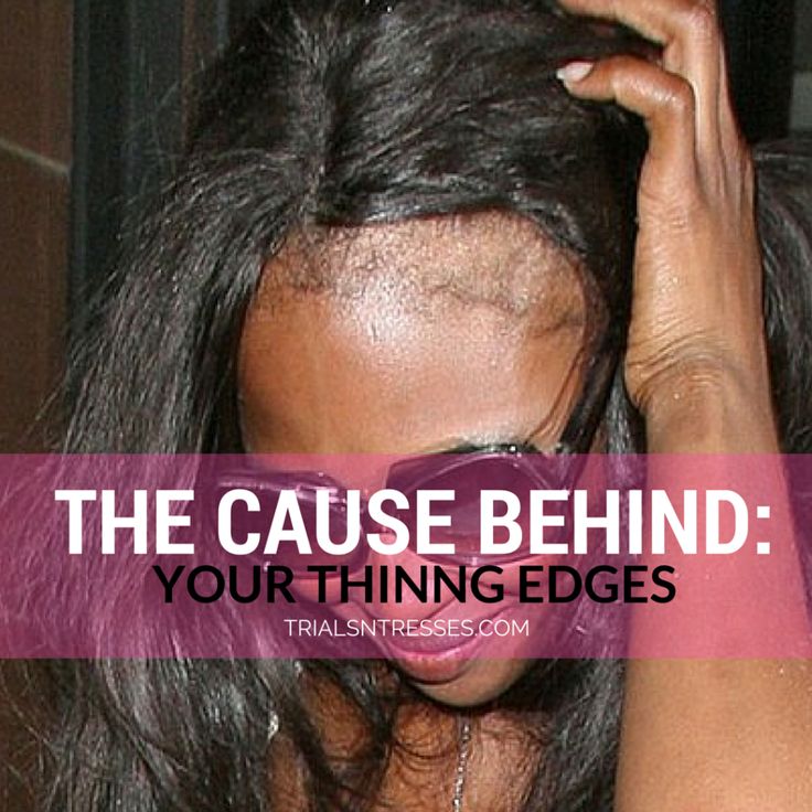 The Cause Behind Your Thinning Damaged Edges