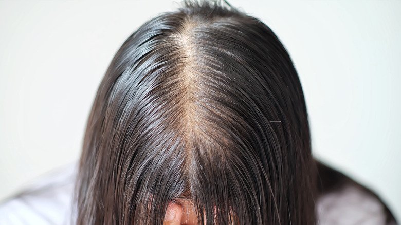 The truth about your thinning hair