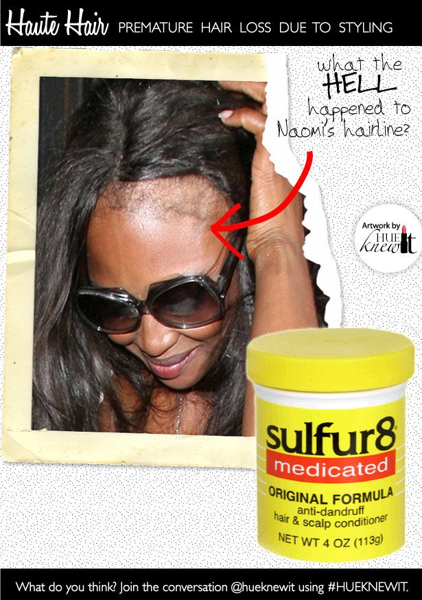 Thicken &  Regrow Thinning Hair with 3 OTC Products