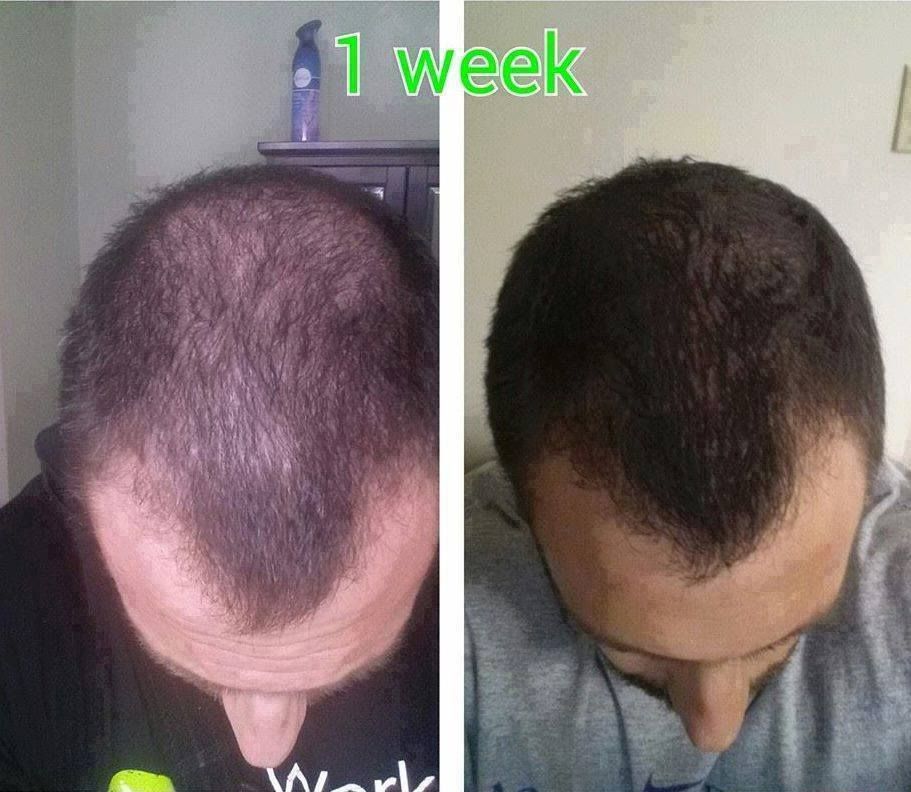 Think ItWorks only has Wraps! NOPE! Do you have thinning ...