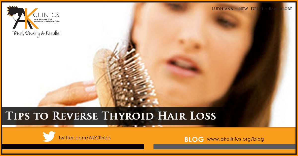 Tips to Reverse Thyroid Hair Loss