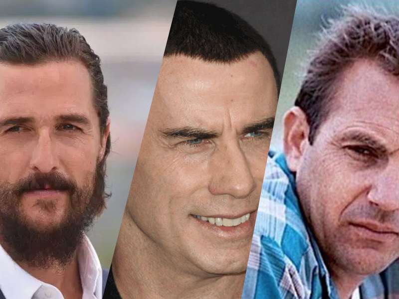 Unbelievable? 10 Celebrities Who Have Had Hair Transplants