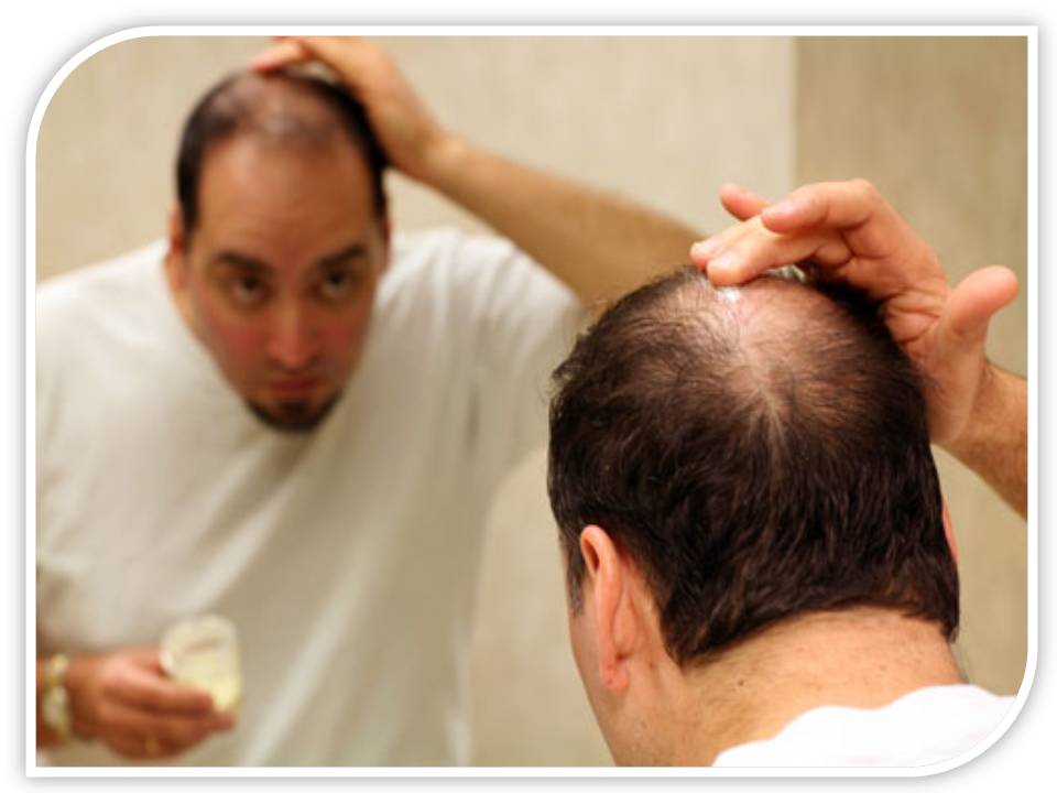 vedaholmes: Sudden Hair Loss Perimenopause : Be Good To ...