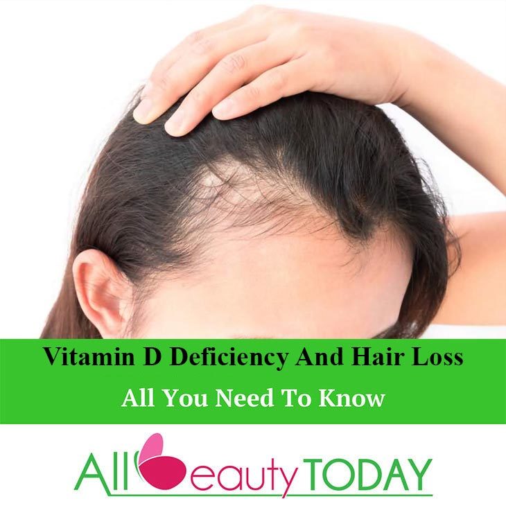 Vitamin D Deficiency Symptoms And Hair Loss