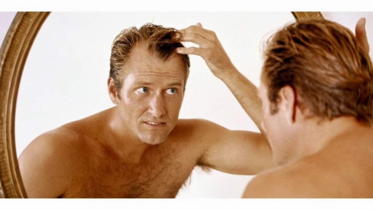 What Age Do Men Start Losing Hair