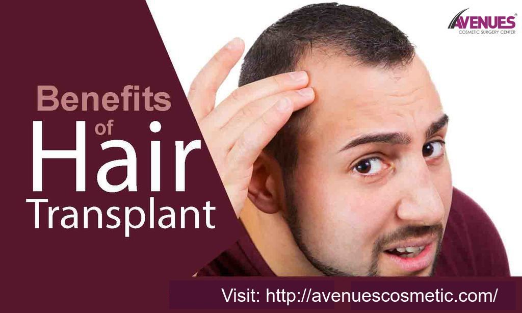 What are the Benefits of Hair Transplant?