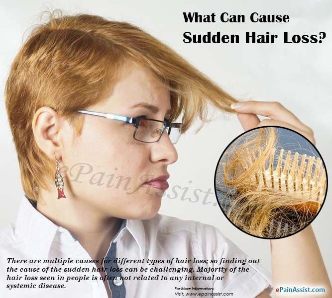 What Can Cause Sudden Hair Loss? #hairlosswomenremedies ...