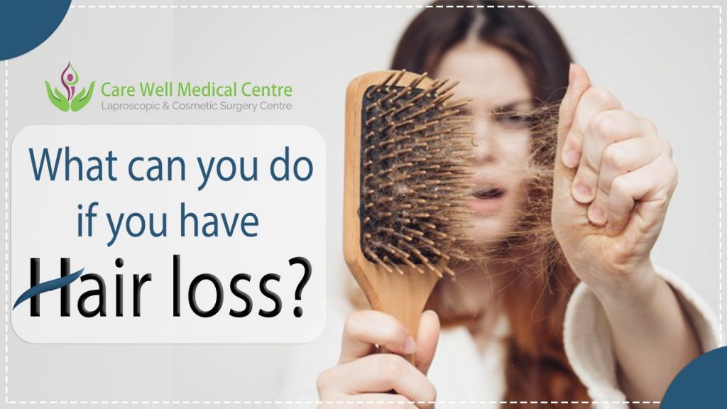 What can you do if you have hair loss?