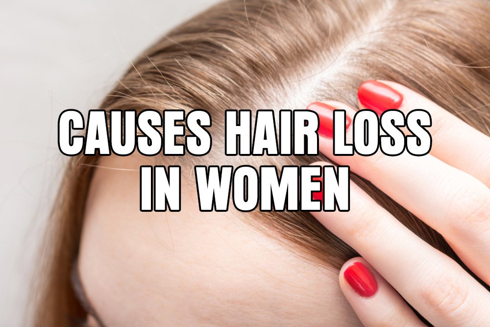 What causes hair loss in women?