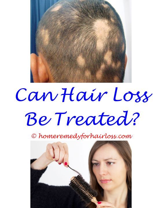 What Kind Of Doctor Do You See For Hair Loss ...
