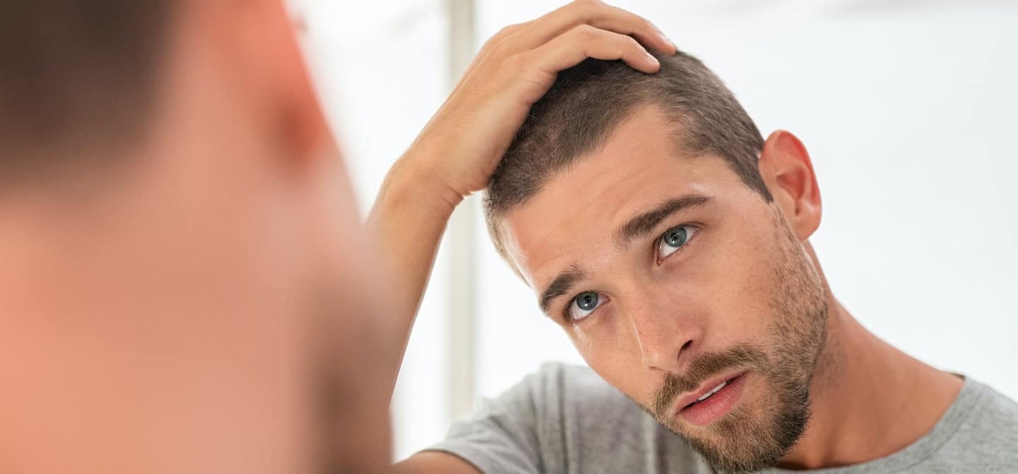 What Really Causes Hair Loss in Men? (And What to Do About ...