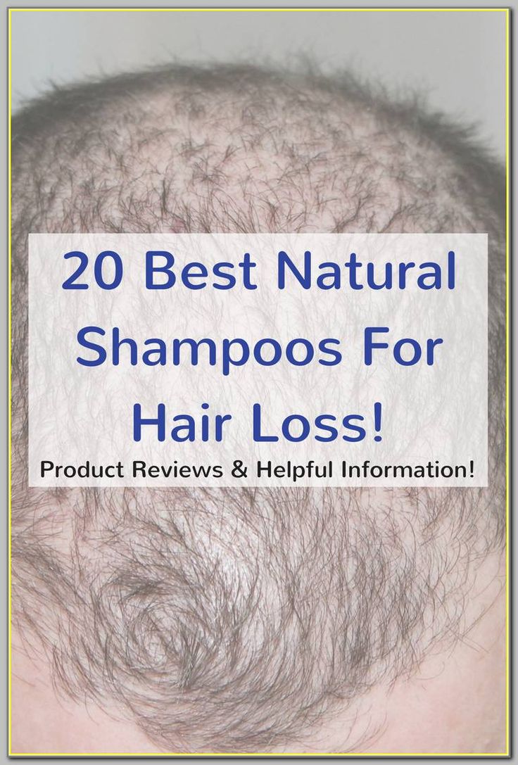 What You Need To Do To Stop Hair Loss ** You can get more ...