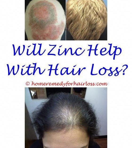 Which Zinc Is Good For Hair Loss