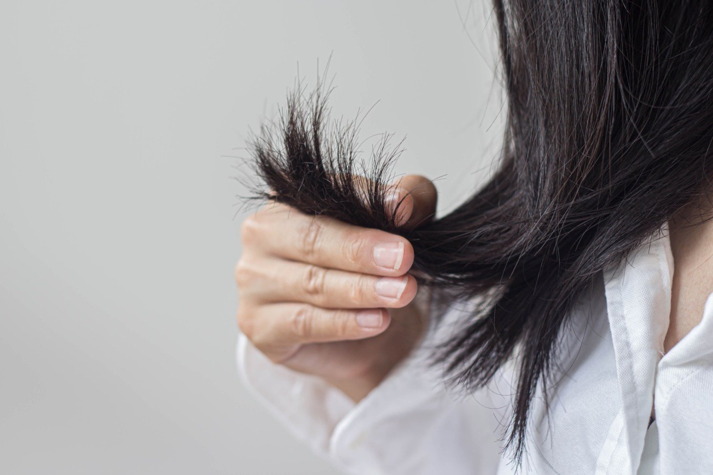 Why Are Young Women Experiencing Hair Loss?